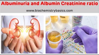 Albuminuria  Albumin Creatinine Ratio  Albumin In Urine [upl. by Nyrb]