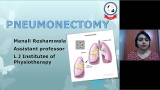 Pneumonectomy by Dr Manali RehamwalaPT [upl. by Anilram]