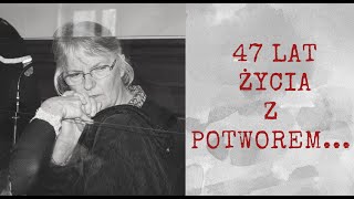 47 LAT ŻYCIA Z POTWOREM [upl. by Mulligan]