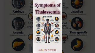 quotThalassemia Symptoms What You Need to Knowquot shorts anemia blooddisorders healthcare wellness [upl. by Octave]