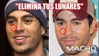 7 REMEDIOS CASEROS PARA ELIMINAR LOS LUNARES [upl. by Neau618]