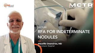 Dr Deandrea RFA for Indeterminate Nodules [upl. by Heddy893]