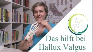 Das hilft bei Hallux Valgus podologinandrea [upl. by Ariane989]