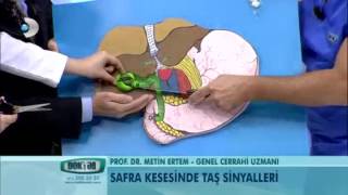 Safra kesesinde taş sinyalleri [upl. by Ahseram]