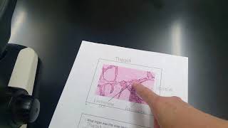 thyroid vs seminiferous tubules histology [upl. by Evyn]