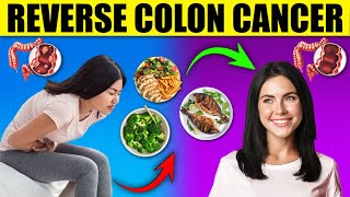 How To Help Reverse Colon Cancer With Diet Changes [upl. by Amado]