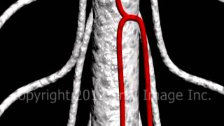 Spinal Cord Anatomy and Blood Supply video  Animation by Cal Shipley MD [upl. by Asseneg310]