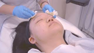 Dr Schrammek Green Peel Facial Yuki Clinic London [upl. by Edmund]