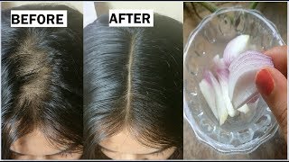 Onion amp Coconut oil for Extreme HAIR GROWTH in 30 Days to get long hair thick hair naturally [upl. by Wolenik88]