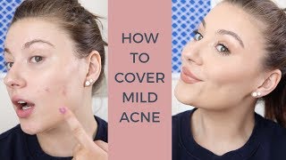 HOW TO COVER ACNE WITH CONCEALER [upl. by Lucienne]