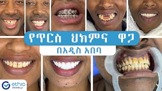 የጥርስ ህክምና ዋጋ በአዲስ አበባ 2015 Teeth Whitening and Dental clinic in Addis Ababa Ethiopia  Ethio Review [upl. by Enomys518]