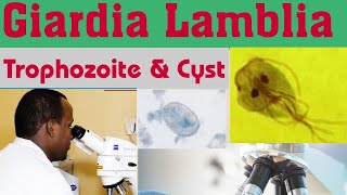 Giardia Lamblia Cyst amp Trophozoite [upl. by Hplar476]