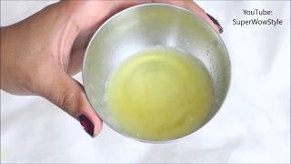 Get Rid of dandruff in 1 Day  Instant Dandruff Remedy at Home [upl. by Afrika]