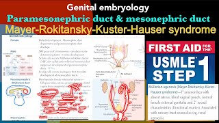 Genital embryology Male amp Female development ￼ Mullerian agenesis in HindiUrdu by USMLE step 1 [upl. by Latonia]