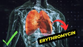 The Benefits of Erythromycin An Overview of Antibiotic Treatment [upl. by Hedy]