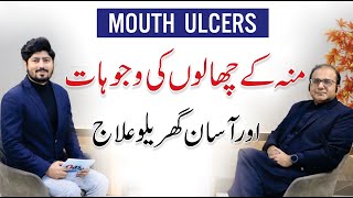 Mouth Ulcer Causes amp Treatment  Muh K Chalon Ka Ilaj  Dr Imran Zia  Dentist [upl. by Icart766]