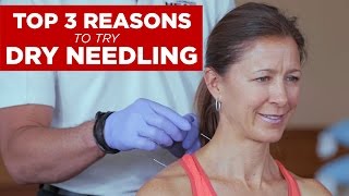 Top 3 Reasons to Try Dry Needling [upl. by Navy]