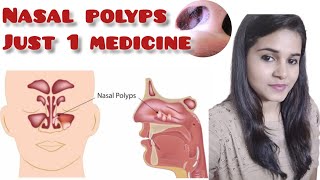 Homeopathic medicine for nasal polyps [upl. by Sparke831]