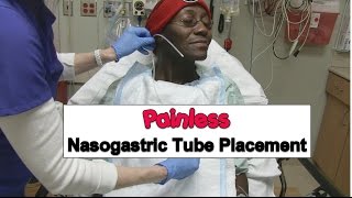 Painless Nasogastric Tube Placement [upl. by Navlys403]