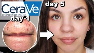 I Used CeraVe Skincare For One Week [upl. by Pauwles]