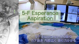 5F Esperance aspiration catheter for AIS acute ischemic stroke エスペランス [upl. by Akvir]