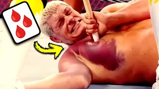 Doctor Reacts To Painful WWE Injuries [upl. by Ardyth602]