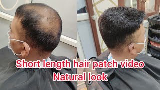 Dubai Apollo hair patch tape and glue method hair pasting short length hair patch video 7306761493 [upl. by Veneaux]