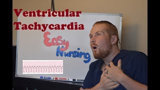 Ventricular Tachycardia  NCLEX Review [upl. by Darby]