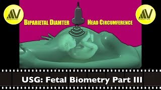 Fetal Biometry Part III BPD HC [upl. by Adnohsek]