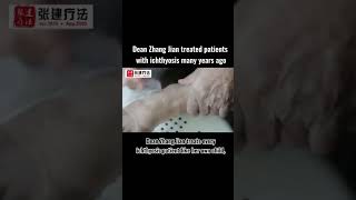 Dean Zhang Jian treated patients with ichthyosis many years ago ichthyosis skincare dryskin [upl. by Jennine371]