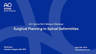 AO Spine NA Fellows Webinar—Surgical Planning in Spinal Deformities [upl. by Atsed]