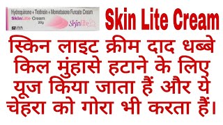 Skin Lite Cream दाद धब्बे और चहरे को गोरा करता हैं। [upl. by Magnolia373]