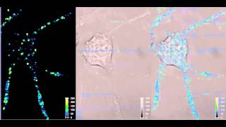 Real time confocal imaging of vesicles trafficking in living neuron [upl. by Jalbert577]