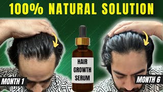 Hair fall kam hoga aur naye baal bhi aayenge  Power of hair growth serum [upl. by Charie525]