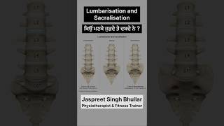 Sacralization and Lumbarization backpainrelief vertigo jassfitness shorts lowerbackpain gym [upl. by Paugh470]