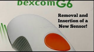 Removal and Insertion Dexcom G6 Sensor [upl. by Viglione]