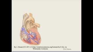 Arrhythmia Bradycardia [upl. by Jaunita649]