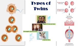 Types of Twins  Dizygotic Fraternal vs Monozygotic Identical Twins  Conjoined twins [upl. by Dnomyaw]