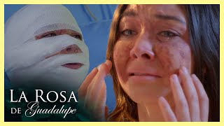 Denisse tiene el rostro desfigurado ¡le inyectaron aceite de bebé  La Rosa de Guadalupe 44 Malas [upl. by Ralina]