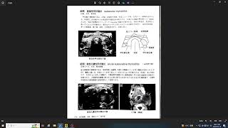 전과 응급 초음파 41 갑상선 경부 증례 1 아급성 갑상선염 2 급성 화농성 갑상선염 [upl. by Tomasz]