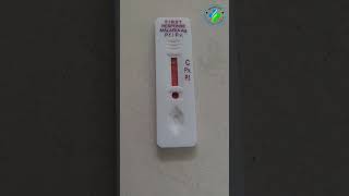 Malaria rapid diagnostic test  Malaria antigen test  Maleria test  plasmodium vivax  P Vivax MP [upl. by Ainit751]