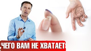 Почему выпадают волосы ломаются ногти и сухая кожа  Каких витаминов не хватает📣 [upl. by Wenda728]