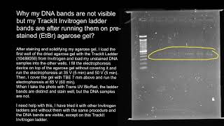 Gel electrophoresis faint bands [upl. by Kosey]