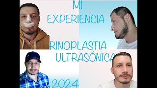 EXPERIENCIA RINOPLASTIA ULTRASÓNICA 2024 [upl. by Basia860]