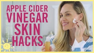 STYLE amp BEAUTY  5 Apple Cider Vinegar Hacks for Your Skin [upl. by Tannenwald999]