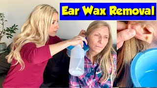 Earwax Removal  Cerumen Impaction amp Ear Irrigation [upl. by Izak]