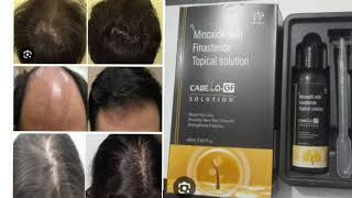 CABELLO GF SOLUTION Minoxidil With Finasteride Topical solution [upl. by Farr893]