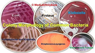 Various Common Bacteria Colony morphology E coli Klebsiella Staphylococcus Pseudomonas and More [upl. by Anibor]