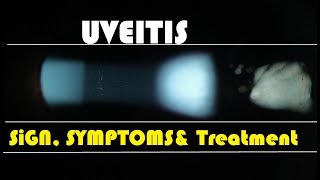 Uveitis Hindi [upl. by Airetnohs]