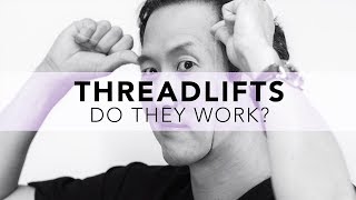 What is the REAL truth about Threadlifts No spin here [upl. by Drehcir649]